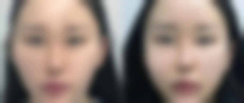 上海美奂纽添医疗美容诊所李东虹医生的口碑怎么样？