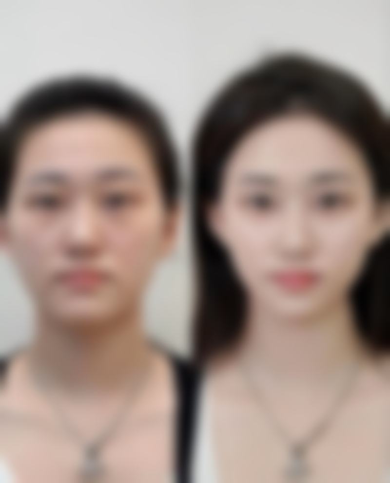 南京春语医疗美容诊所的技术优势,体现在哪些细节?