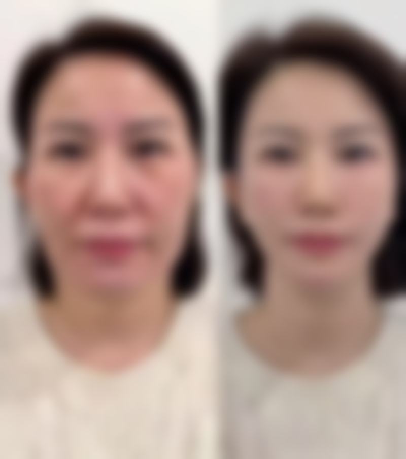 上海美奂纽添医疗美容诊所——你值得信赖的医美之家