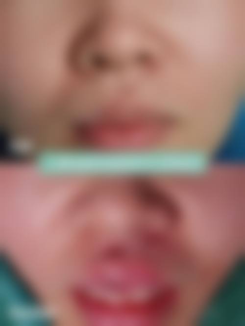 深圳市炫美医疗美容医院口碑反馈:来自就诊者的真实声音