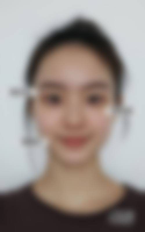 深圳市炫美医疗美容医院医生团队:经验多,操作精细