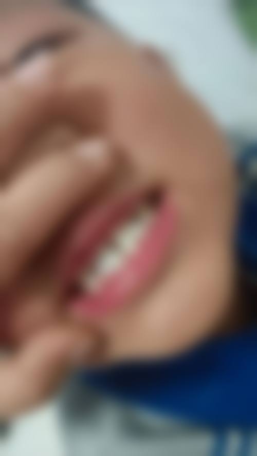 找杭州亮贝美口腔医院的李诗佩医生做矫正，她擅长哪些项目？