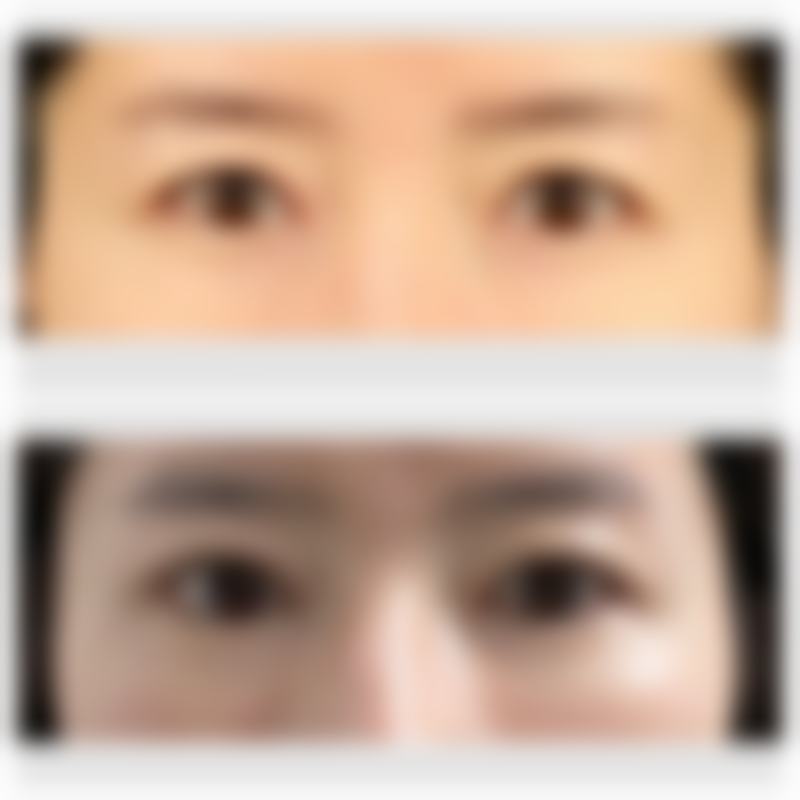 济南木子整形医院的技术与设备有哪些优势?
