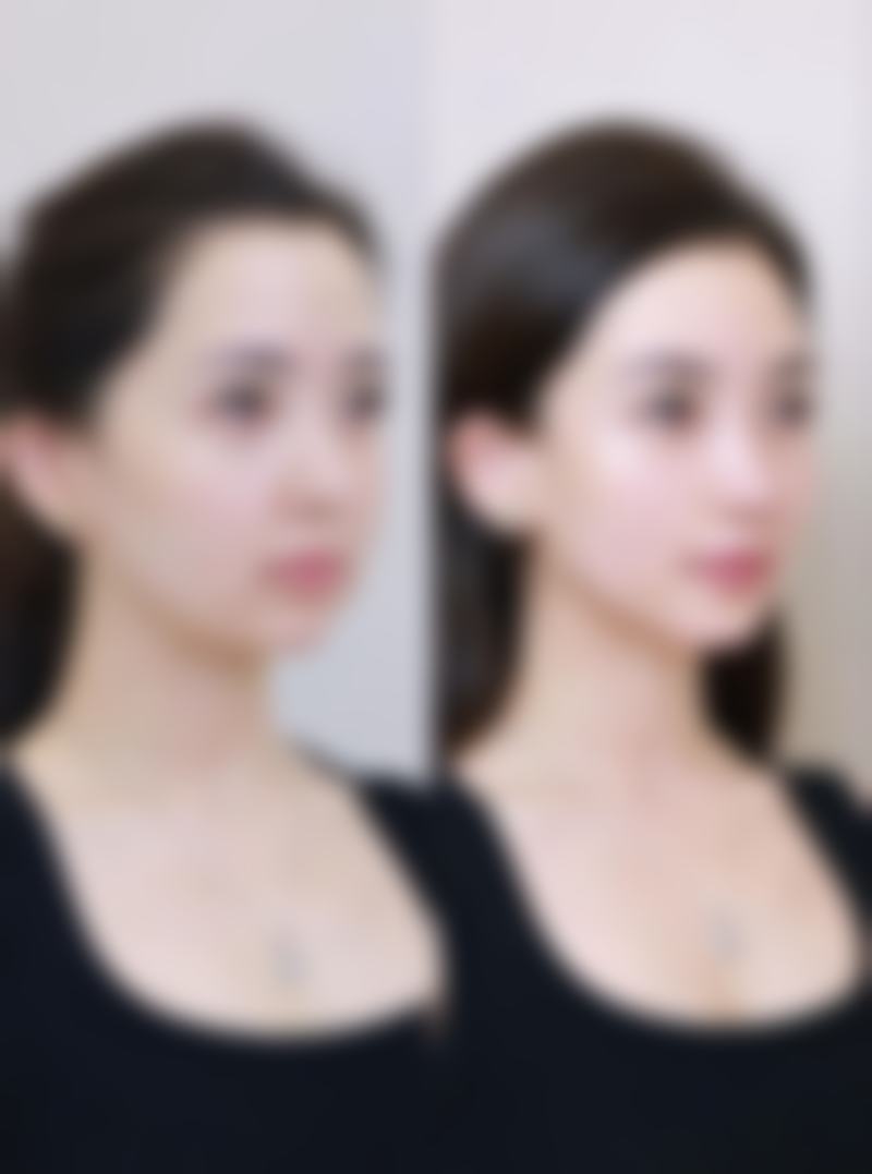 济南木子整形医院项目收费价格参考(2026年)