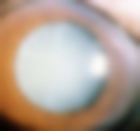 宜良县第一人民医院眼科医生团队:20人的专精医疗梯队