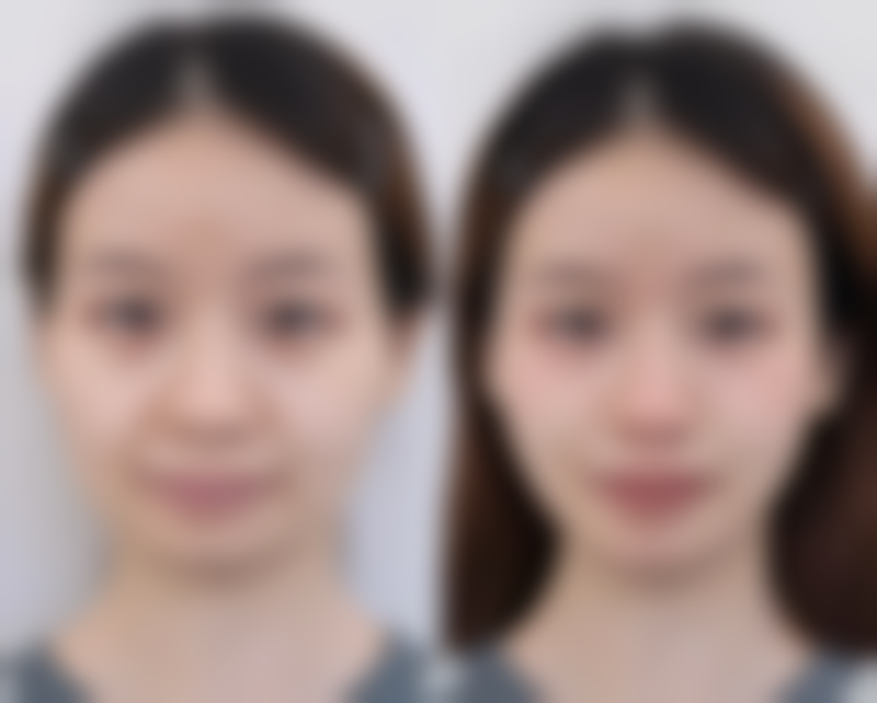 大连美甄颜医疗美容诊所的口碑好评与真实顾客反馈如何?
