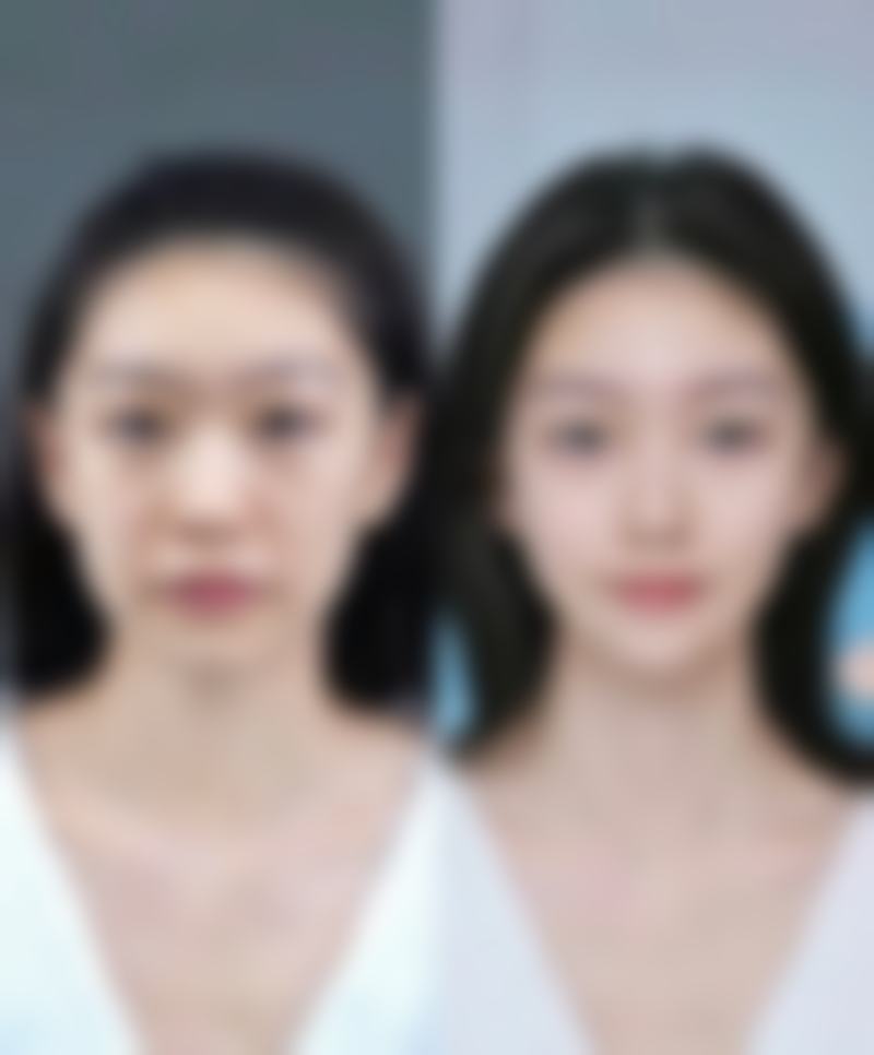 开封市汴美整形医院口碑怎么样?听听这些真实的声音