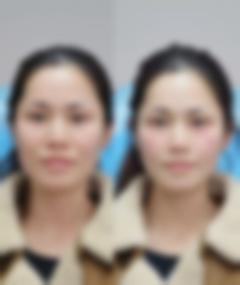 聊城韩美整形医院谢晨阳院长的王牌项目大盘点
