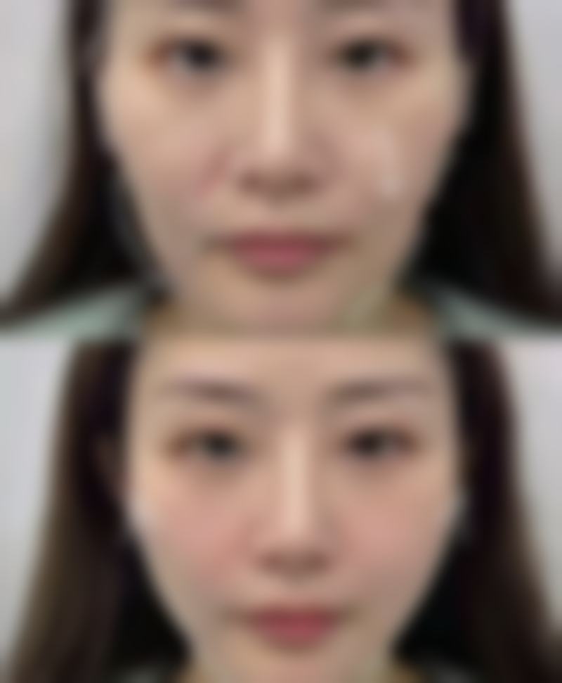 袁磊医生做眼部和鼻部整形技术到底怎么样?