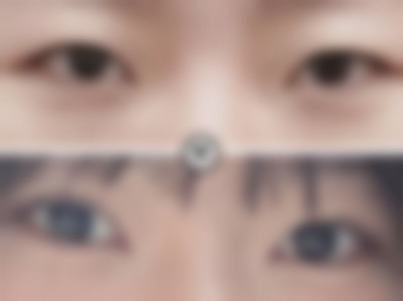 开封市汴美整形医院擅长什么?这些项目藏着技术硬实力
