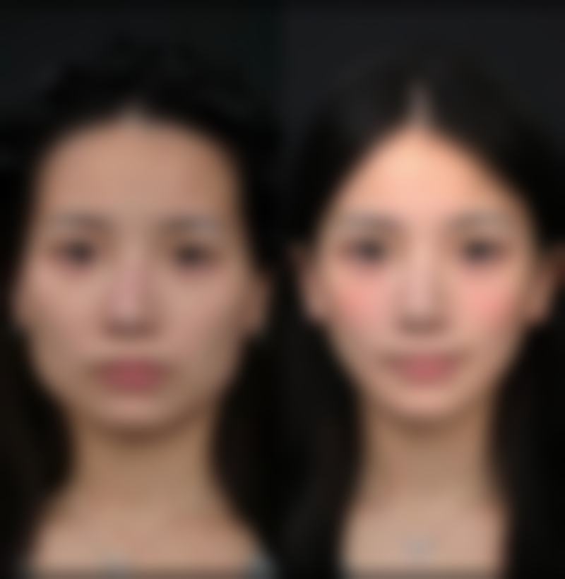 福州闽福医疗美容门诊部收费价格表参考(2026年)