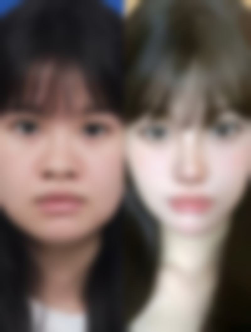聊城韩美整形医院班安华医生做鼻子技术怎么样?精细到0.1毫米