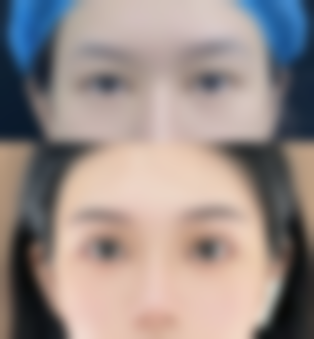聊城韩美整形美容医院班安华医生手术收费价格表(2026年)