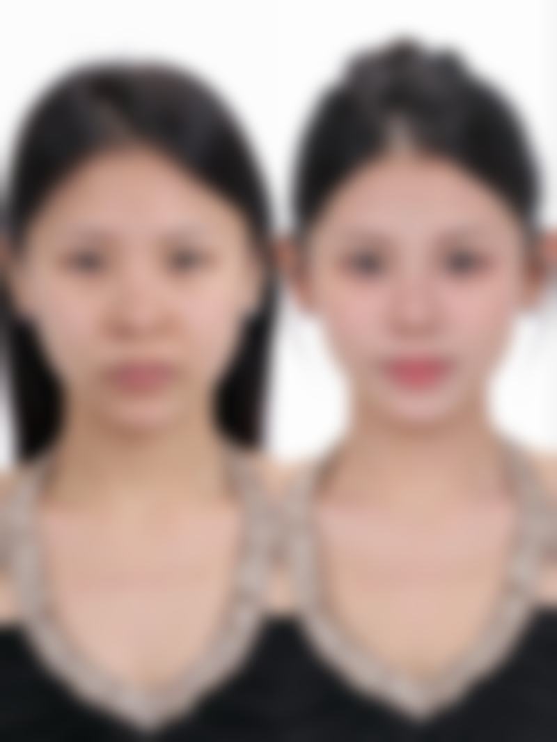 关于南京春语整形医院曾茂医生,这些热门问答或许你也想知道