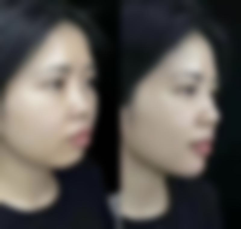 关于杭州医巢医疗美容的快问快答环节
