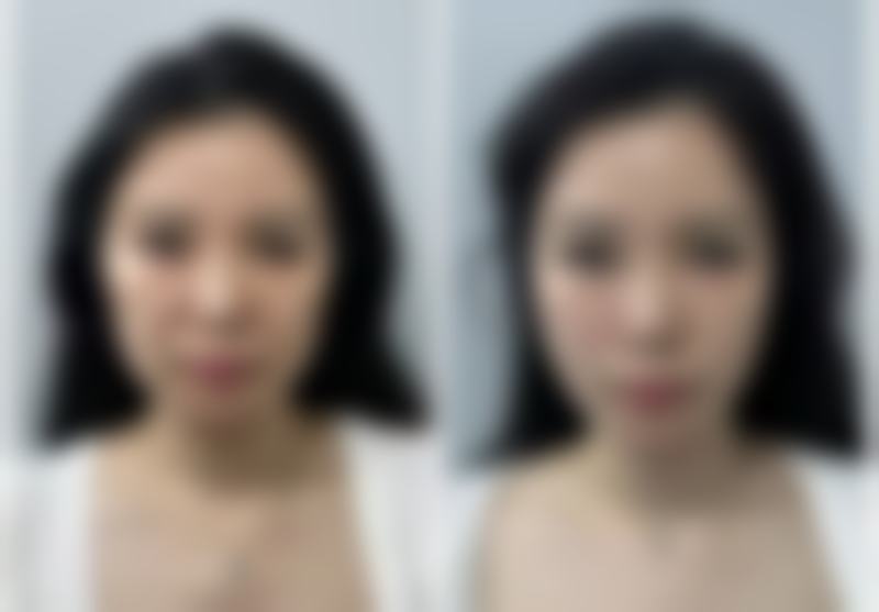 南京春语整形医院环境怎么样?设备正规吗?