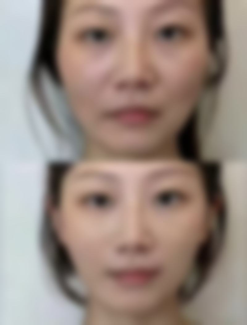 如何快速预约福州闽福医疗美容门诊部?挂号流程及交通指南
