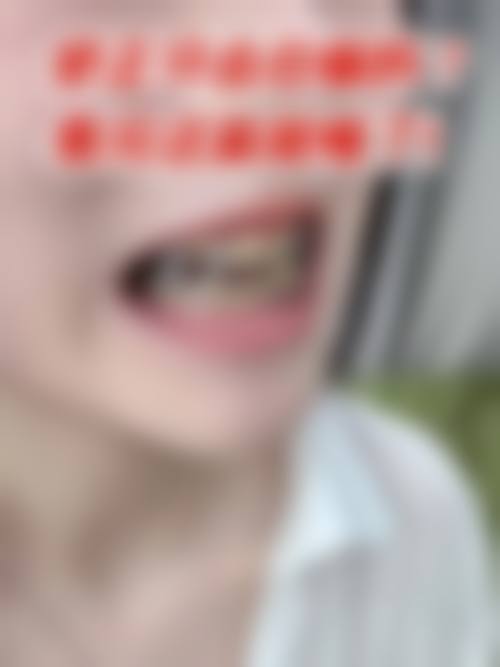 贵阳君雅京恬口腔医院常见问题快问快答