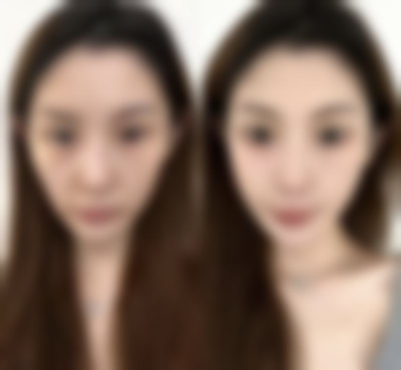 日本美真美容整形外科正规吗?安心如何保护?