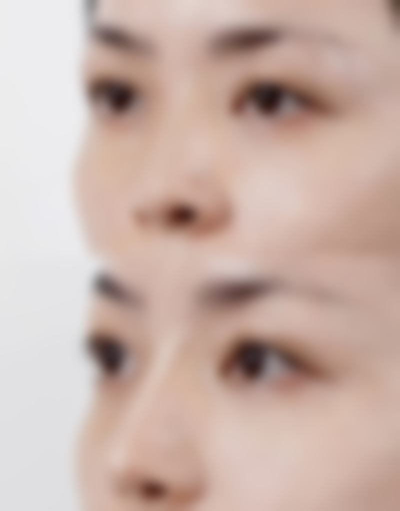 泰国Asia(亚洲)整形医院医生团队:关于Tanongsak院长你不知道的细节