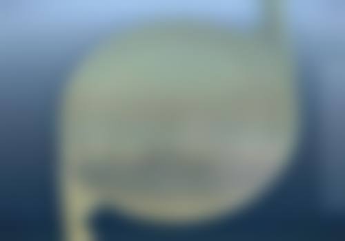 梅州铁炉桥医院眼科有哪些特色项目?
