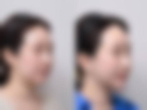 北京嫣然天使颅颜中 心美容医院口碑好评：真实反馈见证蜕变
