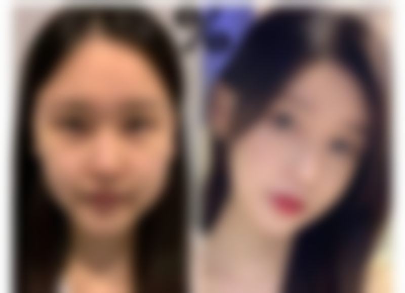 如何预约就诊:便捷通道,开启焕新之旅
