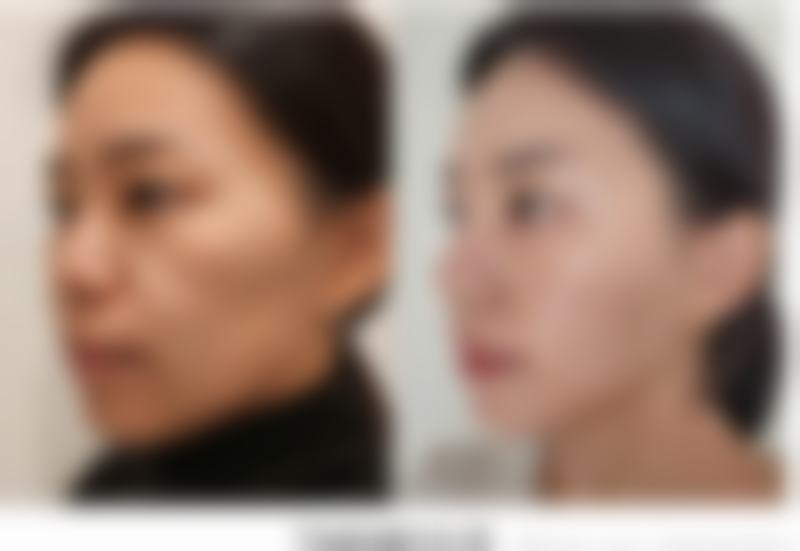 2026年苏州维秘医疗美容诊所收费价格参考