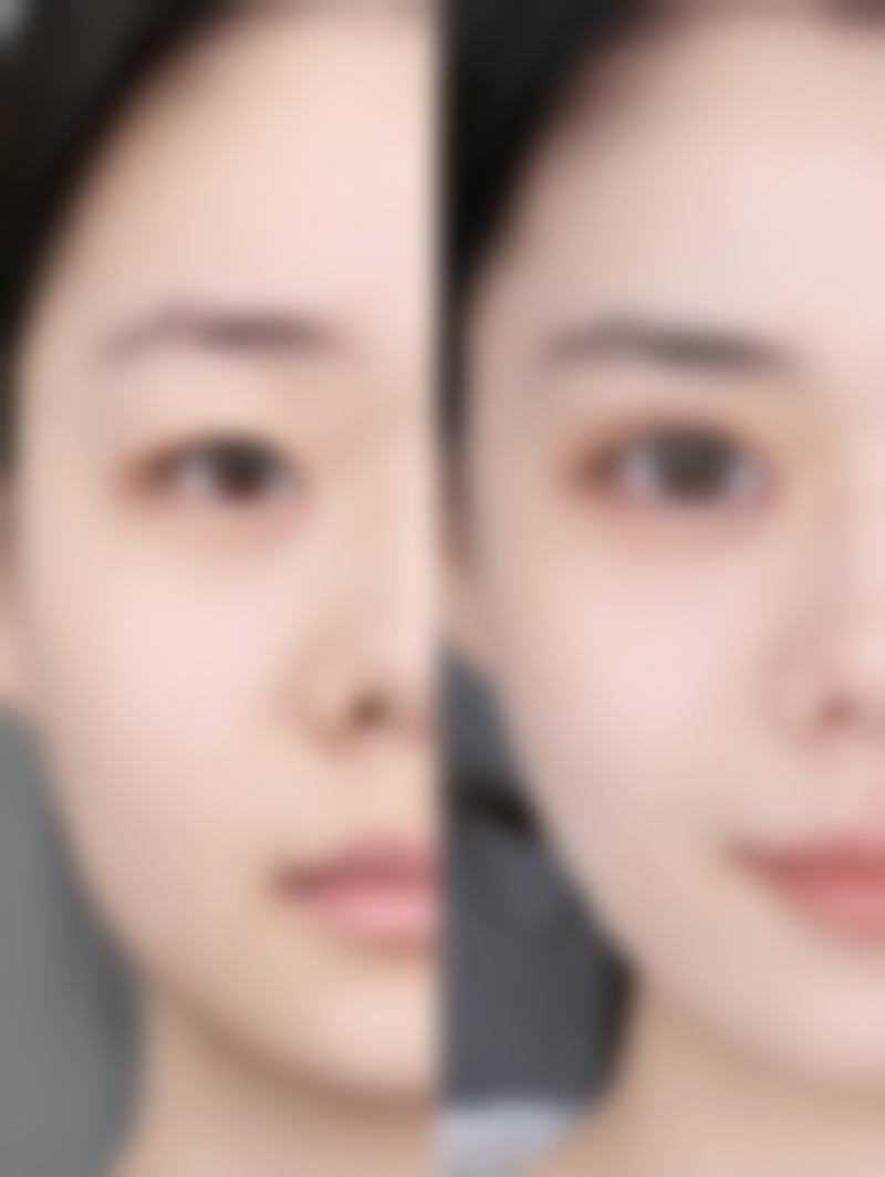 韩国美特乐整形医院怎么样正不正规？硬件与流程的双重保护