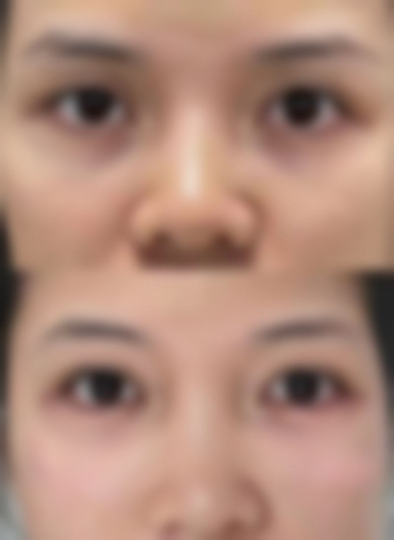 日本美真美容整形外科在哪里？三苫叶子院长怎么预约？