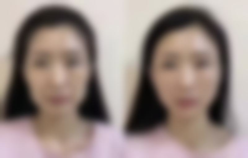 如何预约韩国美特乐整形医院？附就诊疑问贴心解答