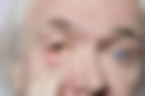 锦州市中 心医院眼科青光眼诊疗技术怎么样？有哪些设备支持？