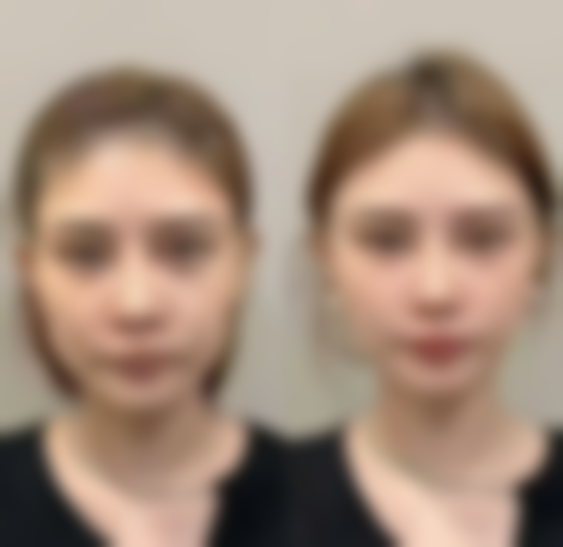 宝鸡虞美人微整形医疗美容门诊部靠谱吗?到底怎么样?
