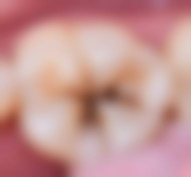 云南曲靖沾益白兔口腔正规吗？可靠不可靠？