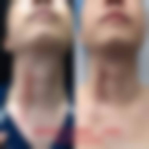 宁波雅韩整形医疗美容门诊部怎么预约?就诊流程看这里
