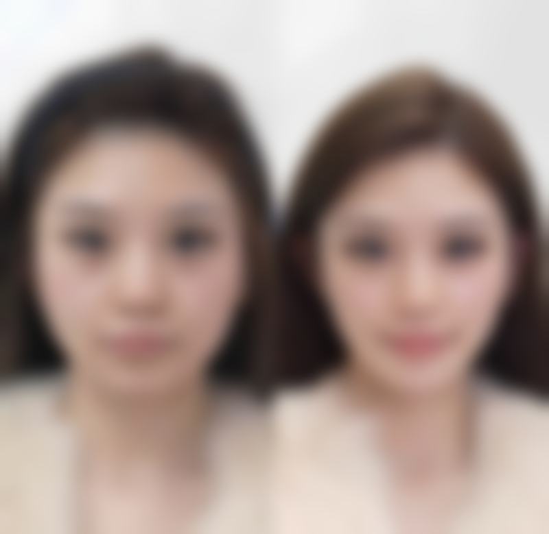 南昌星璨美容医院环境设备怎么样？面诊乘车指南