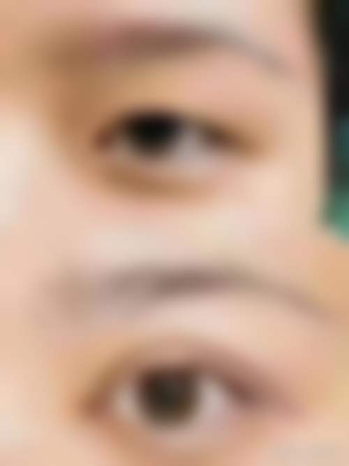 做过的人怎么说?武汉新美谛医疗美容医院的真实口碑反馈