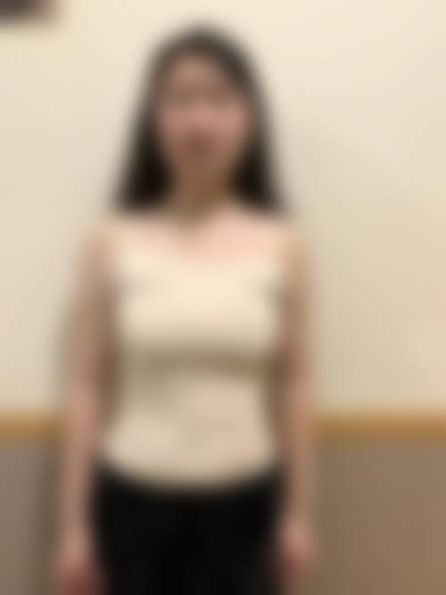 泰国Asia(亚洲)整形医院Tanongsak医生技术怎么样?口碑好不好?