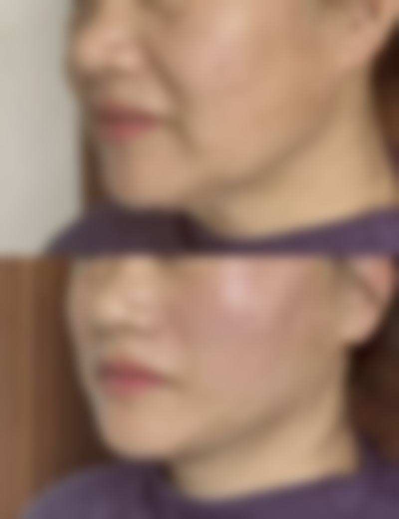 价格贵不贵?2026年武汉新美谛医疗美容医院收费明细参考