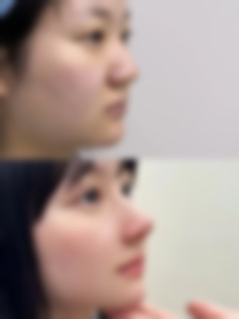 快问快答:关于泰国Asia整形医院Tanongsak医生的常见问题