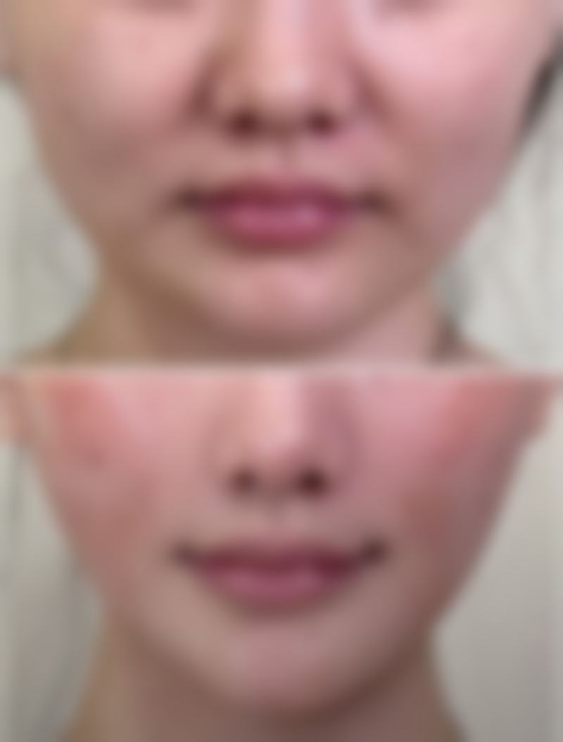 张松林医生在成都金荣整形美容医院，擅长哪些特色项目？