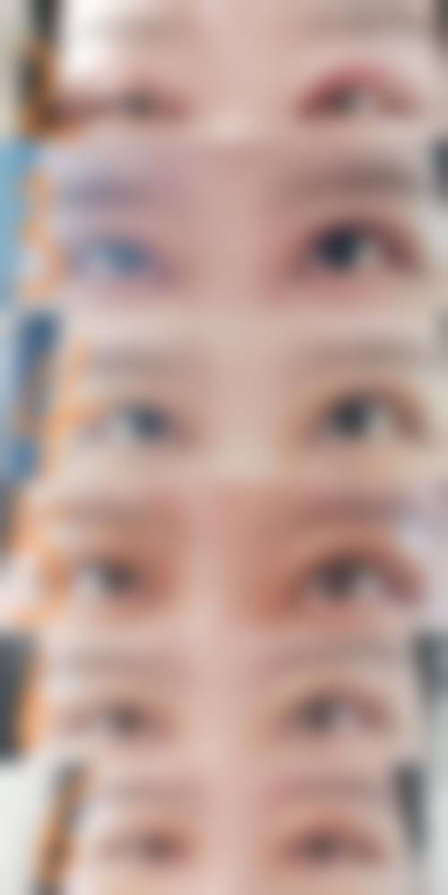 创面美学修复理念与贴心服务流程体验