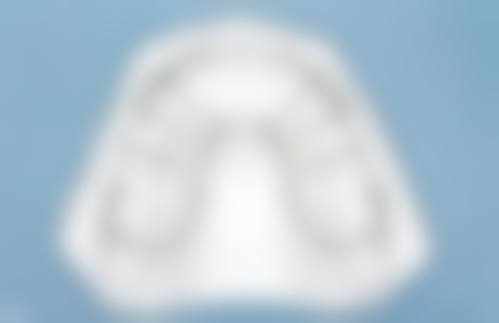 诊疗特色总结杭州艾维春江花月口腔门诊部吴云兵医生
