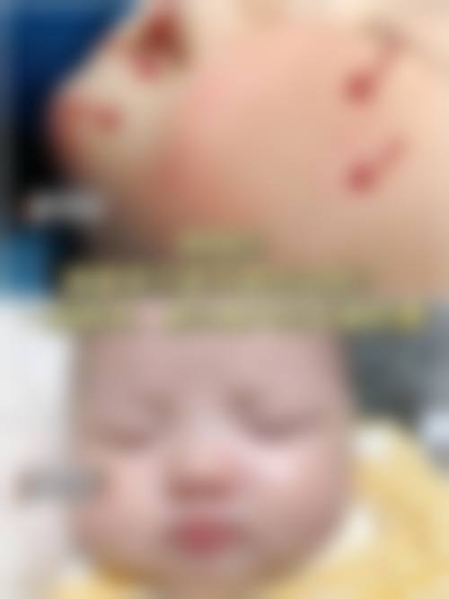 临床实例分享