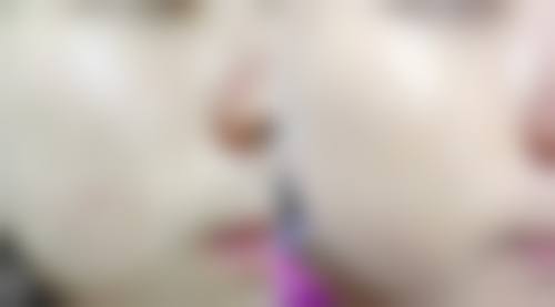 临床实例分享