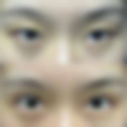 结尾预约号召：龙岩市第二医院眼科邱品生