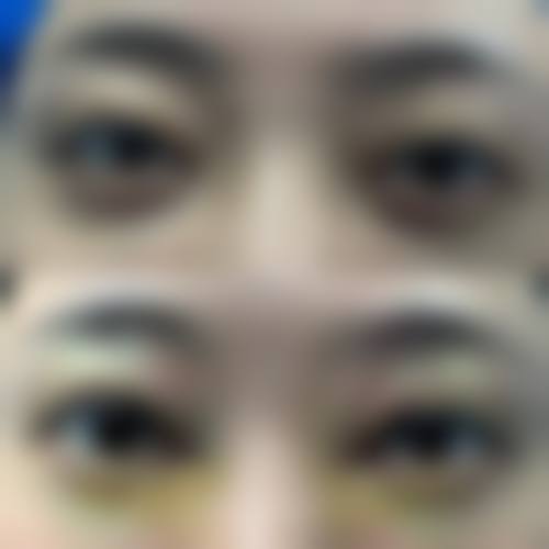 FAQ：关于龙岩市第二医院眼科邱品生的常见问题