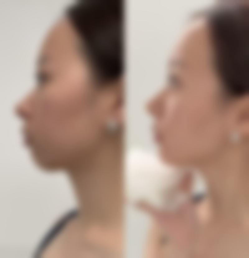 擅长项目详解