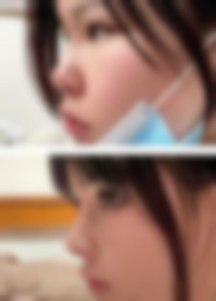 便捷预约：韩国THANKYOU整形外科挂号方式与FAQ