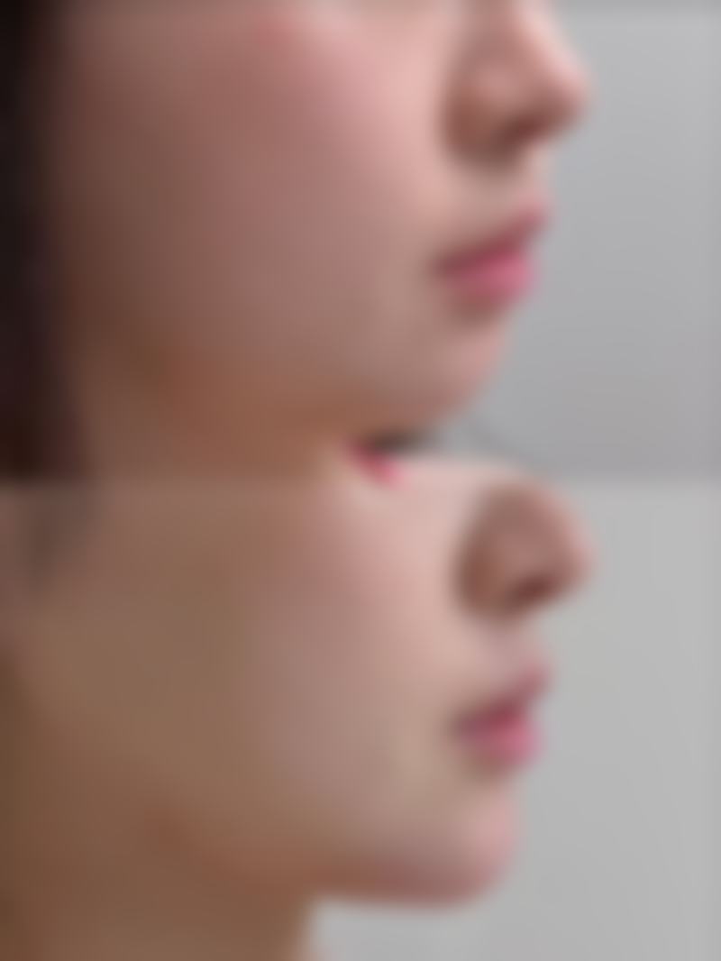 临床实例分享